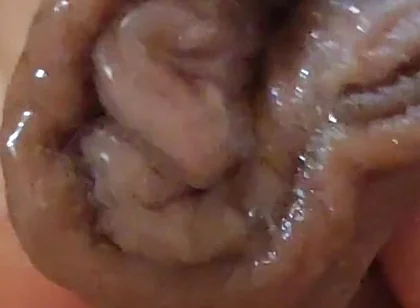 Large Foreskin and Balls in Striking Close-up.