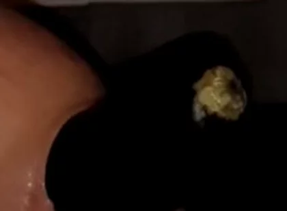 2 Huge Anal Eggplants Insertion ..big Anal Stretching!!
