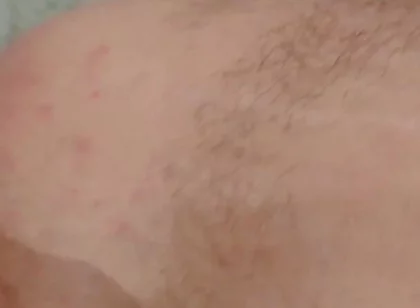 Masturbation