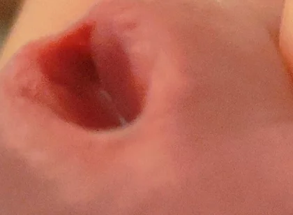 Amazing Closeup of the Widened Hole!!