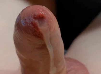 Phimosis Cock Leaking Cum Close-up Hands-free