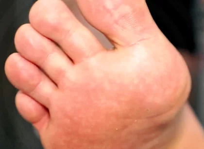 Golden Foot Bath for Pigs