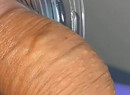 Mysterious Solution Inserted Into the Wrinkled Cock.