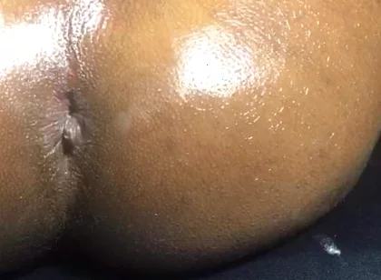 Honey Ass