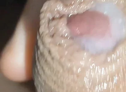 I Have the Largest Ejaculating Phimosis in the World!!
