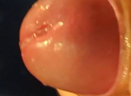 Juicy Close up