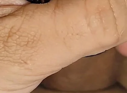 Electrical Pulsation Within the Glans with Rapid Excitation.