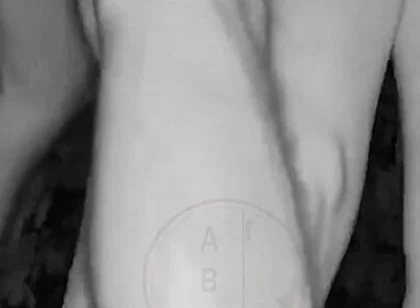 In a Park, at Night, Jules Is Desperate to Pee and Tries to Hide From His Friend but Is Caught on Night Vision Cam