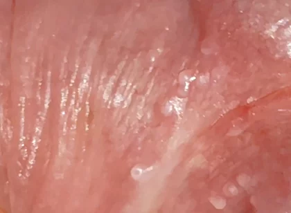 Wide Hole Filled with Pre Cum in Close up