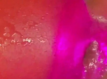 What a Blow Hole