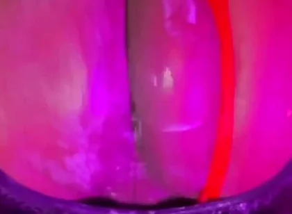 Why Yo Butt so Big?