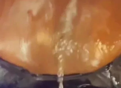Creampie Ejector