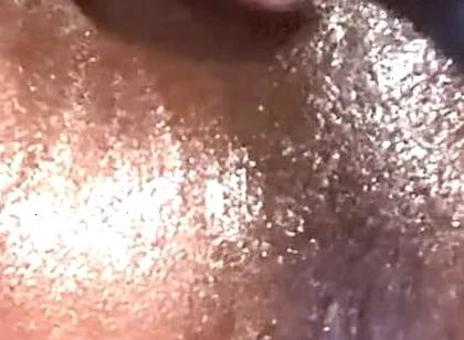 Assplay