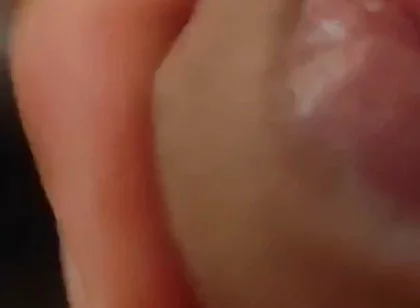Great Phimosis Getting in the Way of the Boy's Orgasm