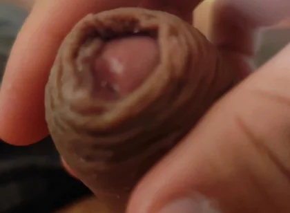 Great Phimosis Getting in the Way of the Boy's Orgasm