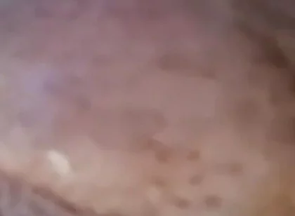 Extreme Fillings Inside My Siliconemeat