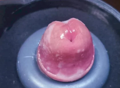 Penis Machine with a New Attachment