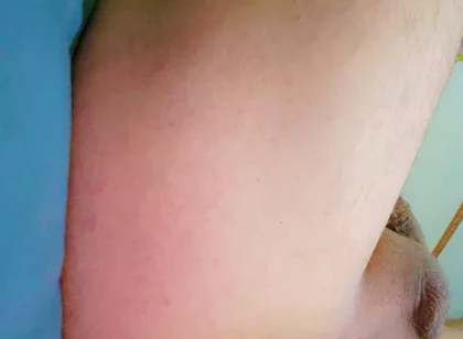 Widening the Ass Opening for Easy Orgasm.