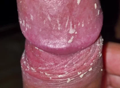 Checking My Dirty Dick