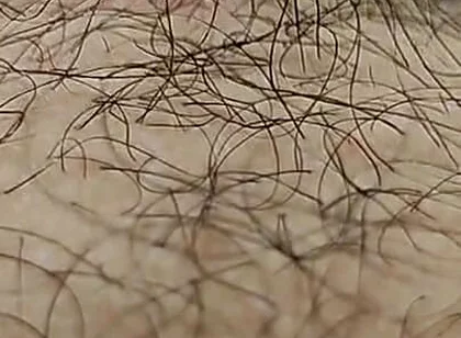 I'm Hairy Boy This My Legs and Dick
