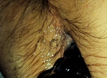 Training My Sloppy Hole