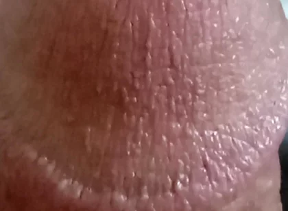 My Dick