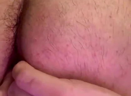 Balloon Anal Inflation