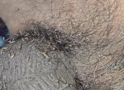 My Bushes Catch Fire Burning Penis Shaved Penis by Fire