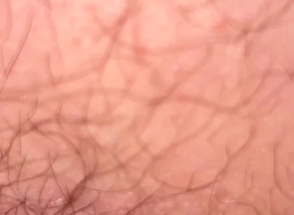 Close up Hairy Hole