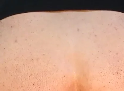 He Enjoys Sucking on His Anal Prolapse