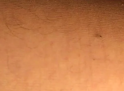 Hard Anal Fisting in Pantyhose