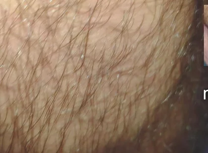 The Texture of the Clothes
