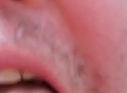 Camera Blunder in the Attempt at Facial Insemination