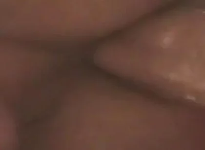 Gaping Anal Prolapse Overflow - Rosebud Pulsing Wide Open
