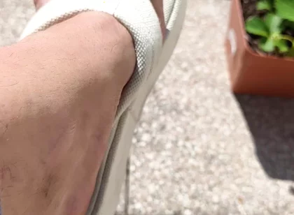 Summer Heels