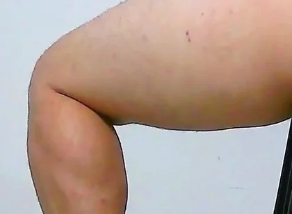 Oh, My Ass Hurts, Apply Ointment