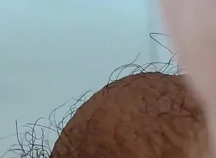 Extreme Open Hole Leaves the Glans Exposed.