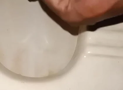 Urinating From the Penis