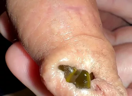 Juicy Small Cock Foreskin Games