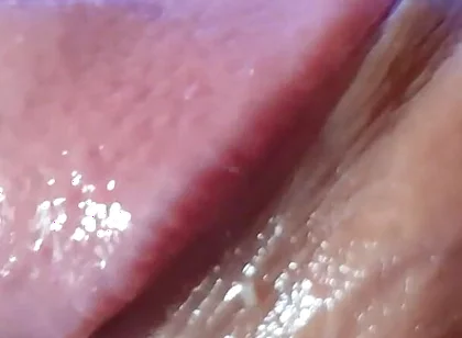 Strange Lumpy Cock with a Gigantic Head.
