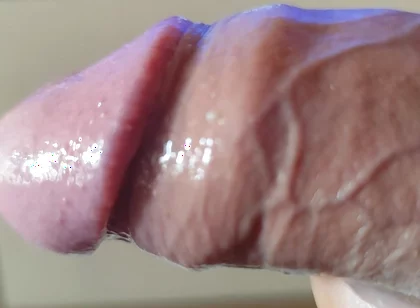 Strange Lumpy Cock with a Gigantic Head.
