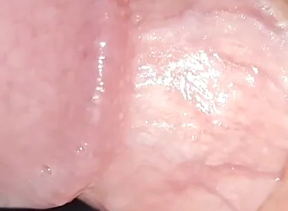 Incredible Cock, Unique of Slippery Phimosis by the Robust Body.