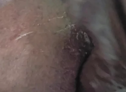 Closeup of My Ass!