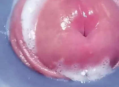 Penis Machine with a New Attachment