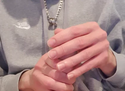 Skinny Lad Pulls Back Skin to Show Bellend