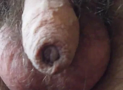 My Penis Walkabout
