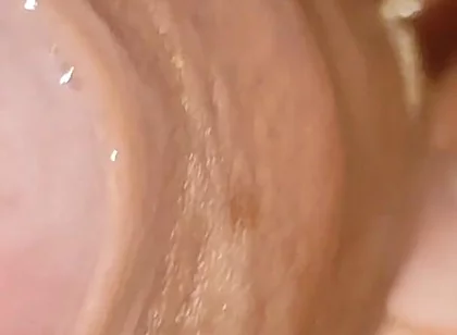 Large Cheese Accumulated in Close up of Glans