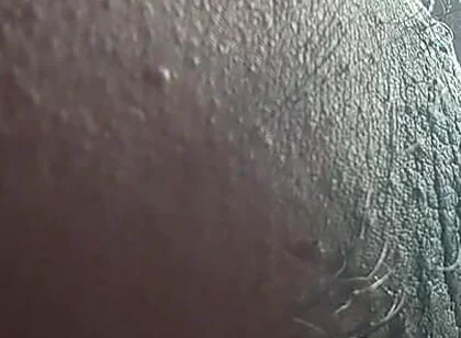 Armpit