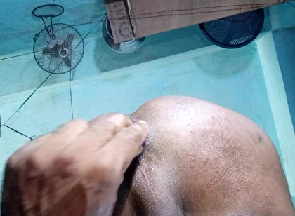 Anal sex