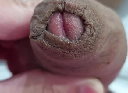 The Head of My Penis